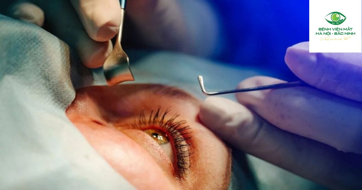 Trải nghiệm của bệnh nhân khi phẫu thuật